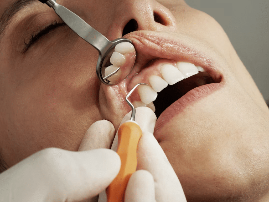 close-up shot of a woman's mouth while being check-up by the dentist