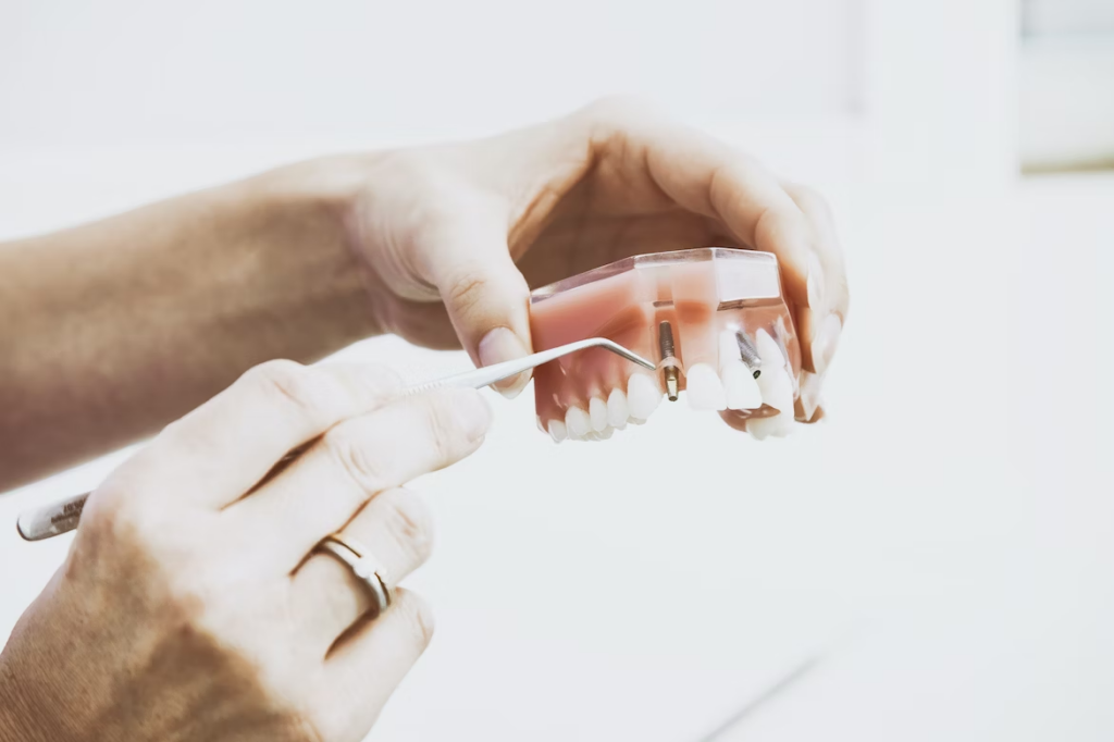 a pair of hands showing how the dental implants is placed into the gums