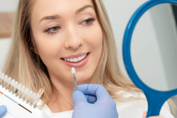 a woman choosing the perfect shade of crown for her implant