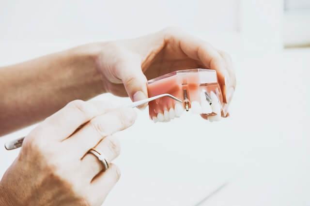 a hand holding a dental model with an implant