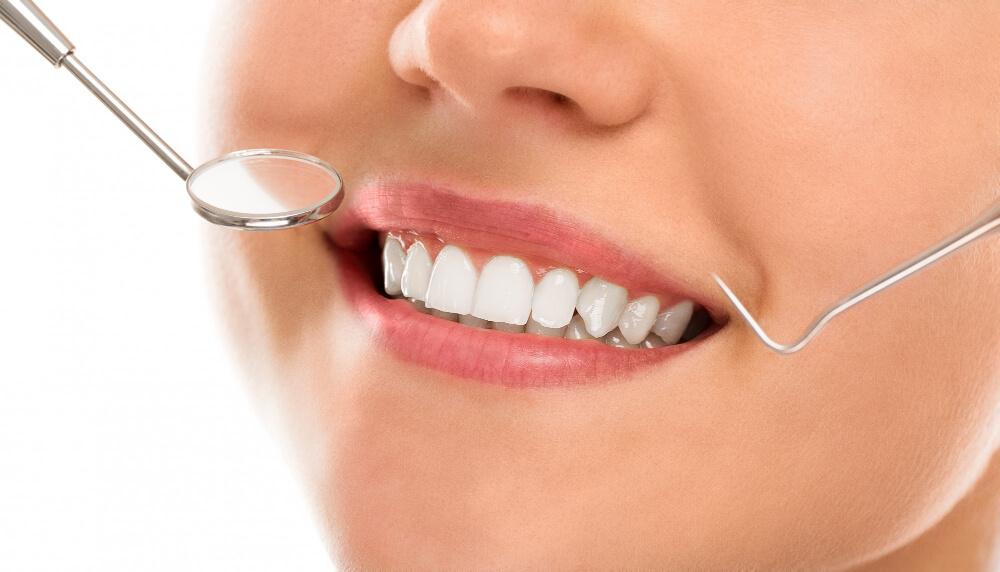 image of a woman's smile with dental tools around it