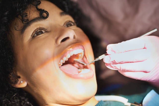 image of a woman with mouth wide open during dental examination