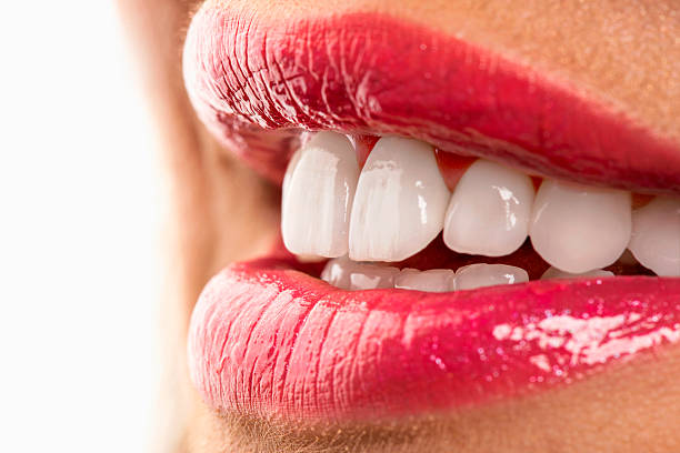 close-up shot of a person's mouth with red lips and veneers