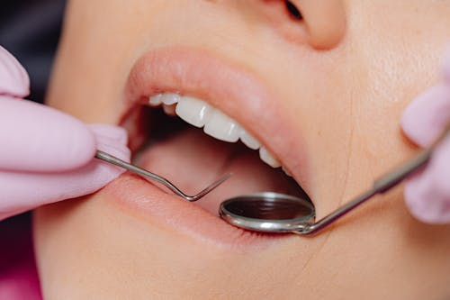 photo showing a person's mouth during a dental exam
