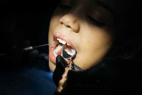 close-up shot of a woman's mouth under a bright light during a dental procedure